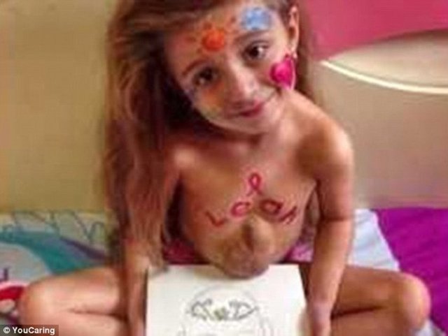 Ekip, iki yıl sonra tekrar küçük kızın bir operasyon geçirmesinin güvenli olup olmayacağını belirlemek için bir değerlendirme yapacak.