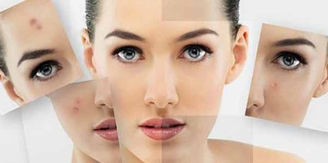 Suna Dumankaya'nın verdiği menekşe maskesi bu soruna bir çözüm getiriyor.