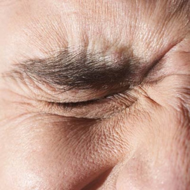 Göz ağrısı: Migren ağrısı genellikle gözün arka kısmında şiddetli ağrıyla kendini gösterir.