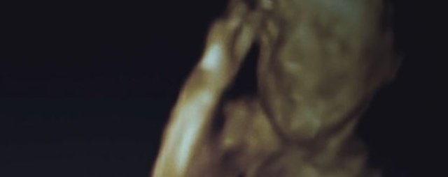 Bebeğin anne karnındaki 3 boyutlu ultrason görüntülerini 3D yazıcı  kullanarak, görüntüyü bir büste çeviren hastane yetkilileri, görme  engelli annenin bebeğini görmesini sağladı.