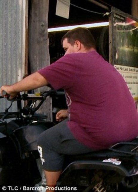 Dailymail'in haberine göre; Tyrone Bowd'a, nadir görülen bir hastalık olan testis lenfödem teşhisi konuldu. İki yıl içerisinde bir mango büyüklüğünden karpuz büyüklüğüne erişen testis torbası, Bowd'un yürümesini oldukça zorlaştırıyor.