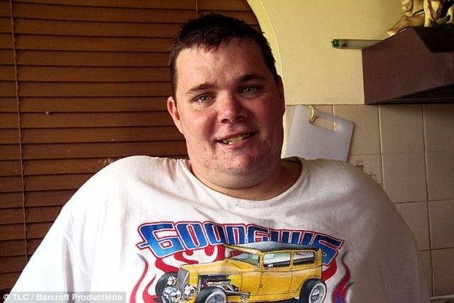  Tyrone Bowd, yakın dönemde testisini tarttı ve onun 5,44 kilo olduğunu keşfetti. Bunun anlamı Bowd her gün iki bacağının arasından sarkan, neredeyse bir taş ağırlığındaki testisleri taşıyor. - Aylar sonra muayeneler ve testlerin ardından ona testis lenfödem teşhisi konuldu. Bu hastalık lenf damarının tıkanmasına neden olan bir hastalık… Sonuç olarak ise, doku testisin dışına doğru büyüyor ve testis de şişmeye devam ediyor.