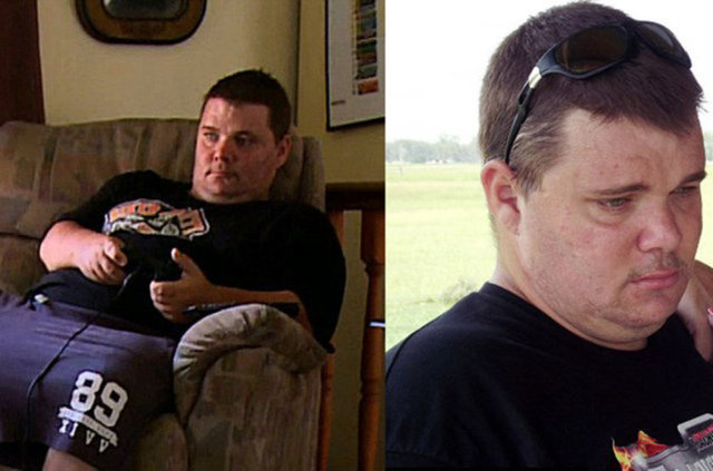 Oğlunun testisinde mango büyüklüğünde bir şişlik vardı, oğlunu yerel bir hastaneye götürdü ancak çekilen ultrason, hastalığa dair herhangi bir ipucu vermedi.