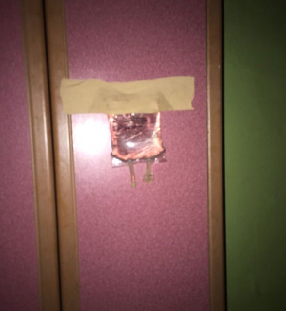 Şırnak'ın Cizre ilçesindeki çatışmalarda yaralanan teröristlerin, bölücü terör örgütü üyelerince tedavi edildiği ev ortaya çıkarıldı.