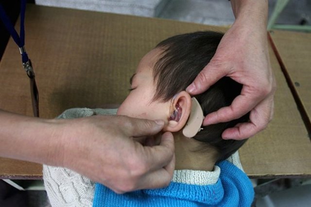 Odyoloji teknisyenliği