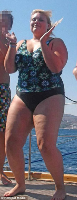 Doktorların uyarılarını dikkate almayan ve sürekli şekerli besinler tüketen genç kadında ileriki yaşlarında körlüğe sebep olabilecek retina hasarı tespit edildi. -  