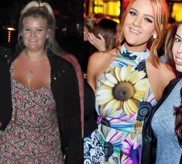 25 yaşındaki Anderson, bu süre içinde, bedeninin verdiği kilolar yüzünden sarkan bölümlerini de estetik cerrahların ellerine teslim etti.