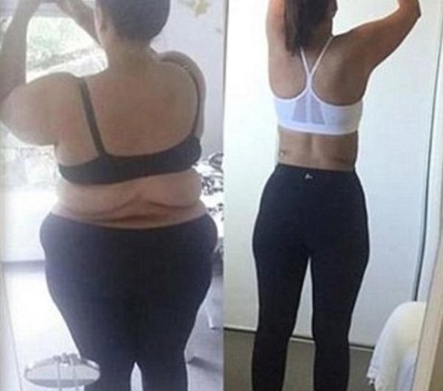 Genç kadın o dönemde evinde çöp dökmeye bile zorlandığını yürümenin kendisi için kolay olmadığını söyledi. -  