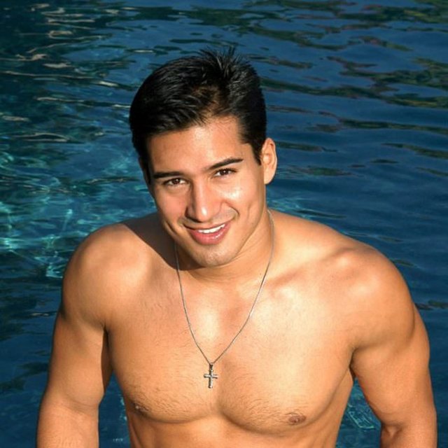 Tekniklerin biri deri altindaki dokunun azaltılması şeklindedir. Diğer teknik ise deri altındaki dokunun yüzdeki mimik kaslarının tespit edilmesi şeklindedir. Bazı durumlarda bu iki tekniğin kombinasyonu gerekebilir.Mario Lopez -  