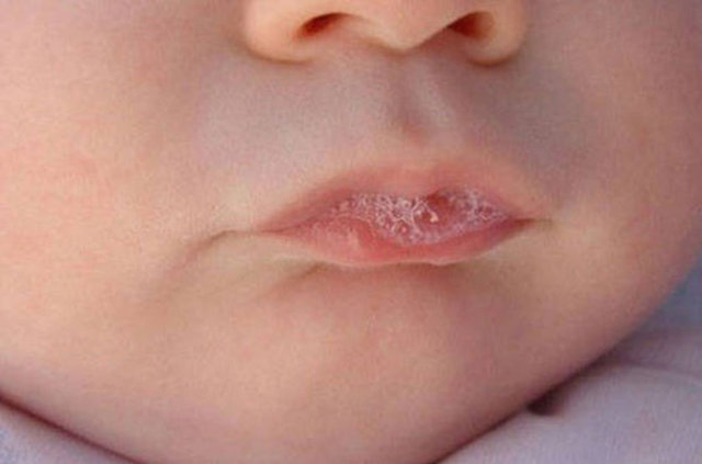 Diş hijyeni açısından da su oldukça önemlidir. Su, sindirimi kolaylaştırır ve ağzı temizleyen tükürüğü artırır. Diş çürüklerini önler.