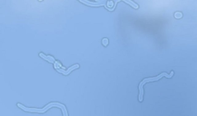 Zaman zaman gözümüzün önünde oluşan ufak şekiller (takip de edilebilen), gözün vitröz sıvısındaki proteinlerin yansımasıdır.