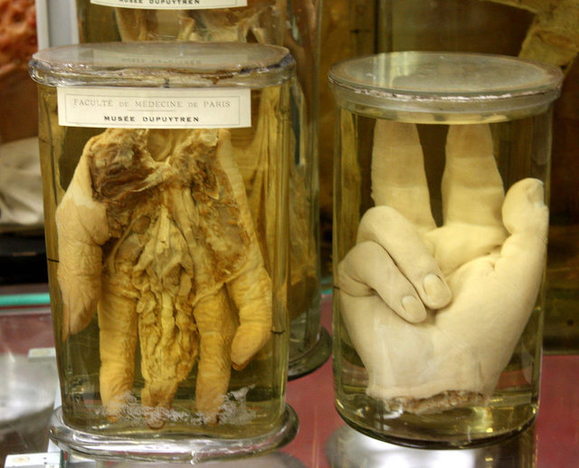 Müzenin içinde ki çoğu parça, formaldehit içinde korumada. Modern dünyanın ilk seri katili kabul edilen, Si Ouey Sae'nin mumyalanmış cesedi bile bu müzede.