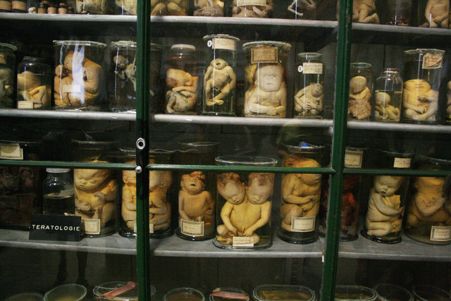 TIP MÜZESİ / MUSEE DE LA MEDECINE / FRANSA