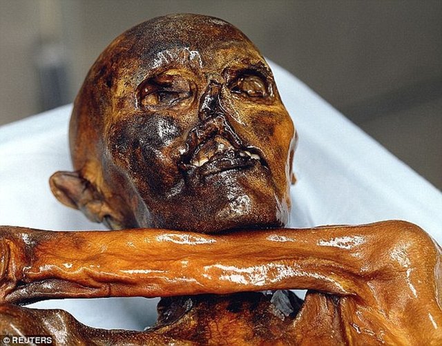 2001'de Otzi'nin omzunda bir okbaşı bulunmuş ve sırtından vurulduğu anlaşılmıştı. Otzi'nin dakikalar içinde yoğun kan kaybettiği ve muhtemelen başından son bir darbe aldığı belirtiliyor.