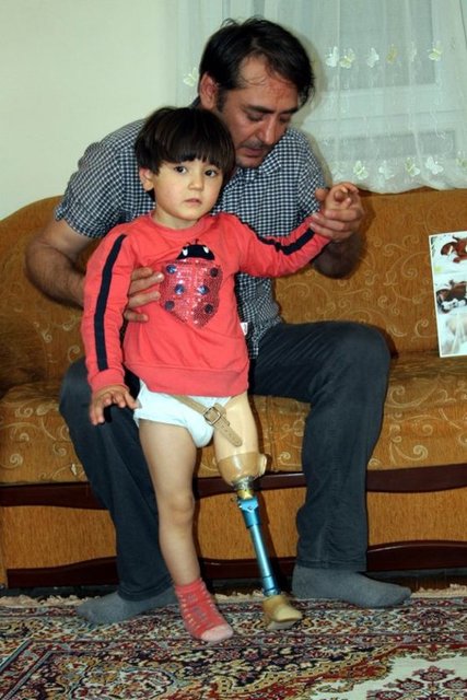 Antalya'da alüminyum doğrama ustası Ali İhsan Yıldırım, 6,5 aylık prematüre doğduktan sonra bacağı kesilen 3 yaşındaki kızına yürümeyi, 150 liraya kendi elleriyle yaptığı düzenekle öğretti.