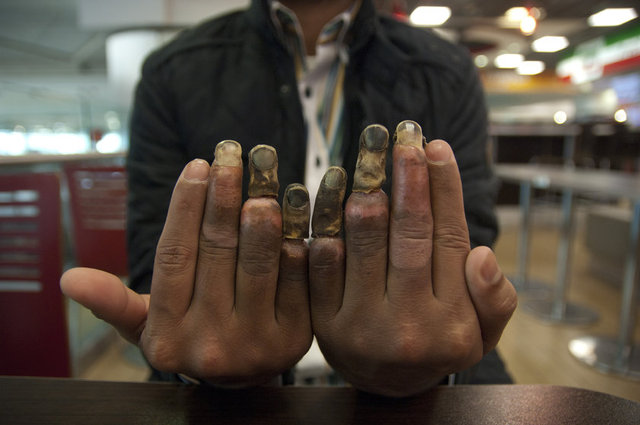 ÜZEYİR NAUMİ'NİN DAHA İYİ BİR HAYAT İÇİN ÖDEDİĞİ EN BÜYÜK BEDEL, AİLESİNİN VE KUZENİNİN UMUT TACİRLERİNE KAPTIRDIĞI PARALAR DEĞİL, BU ELLER OLDU. FOTOĞRAFLAR: SERHAN SEVİN / HABERTURK.COM