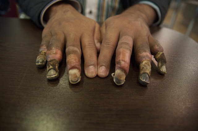 PHOTOS: SERHAN SEVIN / HABERTURK.COM