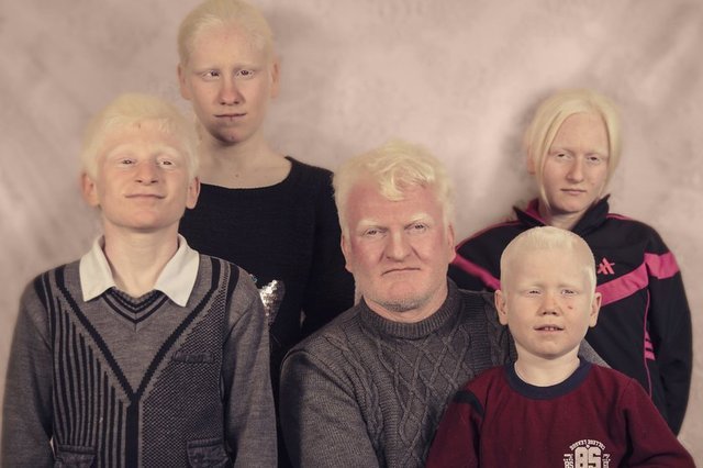 Ten renklerinin farklılığı nedeniyle "Albino" olarak bilinen Albinimzli bireylerin kimi askerliği düşlüyor, kimi güneşli bir havada uzun uzun denizi izlemeyi, kimisi de özgürce sokaklarda müziğini yapmayı istiyor.