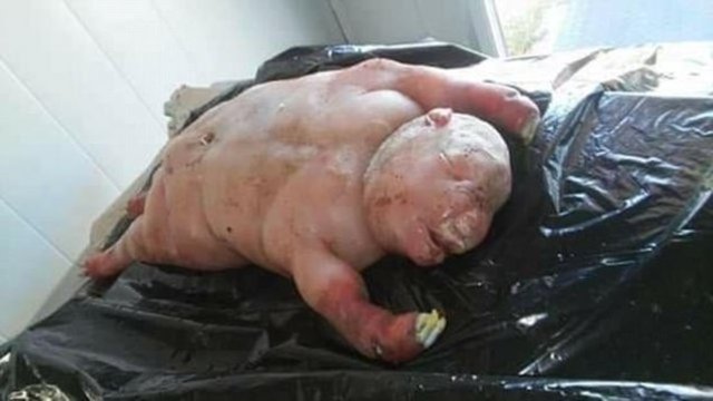 Konu hakkında açıklama yapan uzmanlar koyunun hamilelik döneminde virüs kaptığını söyledi.