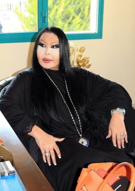 Ayrıca bir şovunda farklı bir makamla şarkı okuduğu için böbreğinden vuruldu ve o böbreği alındı. 