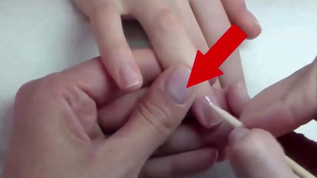 TIRNAKTAKİ BEYAZ YARIM DAİRESağlıklı insanların elinde bu yarım daire net bir şekilde görülür. Sağlık sorunları yaşayan insanlarda bu daire kaybolmaya başlar.