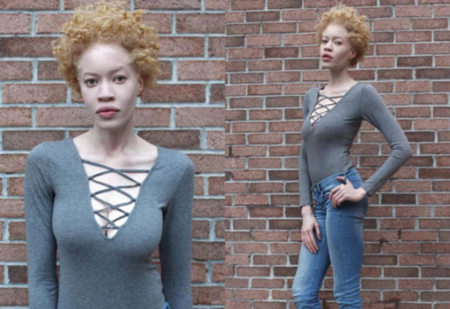 Moda dünyasındaki güzellik kalıplarını altüst eden bu model, aynı zamanda albino kişilere farkındalık yaratmak için de mücadele ediyor… -  
