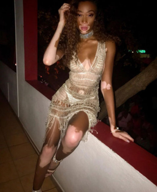 Küçüklüğünden beri alaylara, kötü yorumlara maruz kalan genç kadın okulda karşılaştığı dışlayıcı tutum nedeniyle eğitimini yarım bıraktı. -  