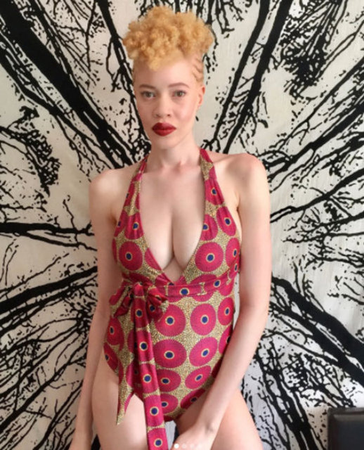 Alışveriş yaparken fotoğrafçı Shameer Khan tarafından keşfedilen genç kadın o günden itibaren de büyük modellik ajanslarında çalışan ilk albino model oldu. -  