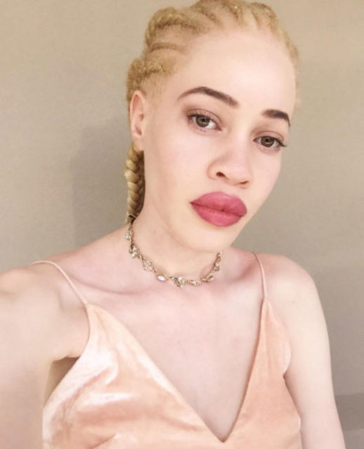 Afro-Amerikan ve albino Diandra Forrest, 1989 yılında New York'ta dünyaya geldi. -  