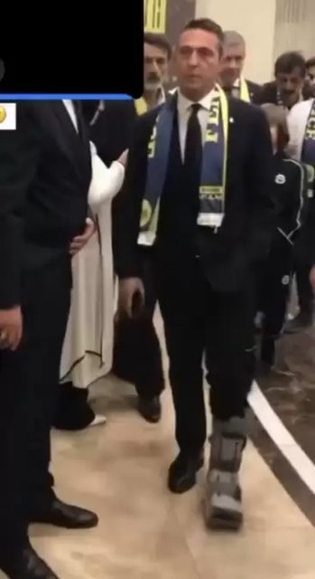 KOÇ HOLDİNG BAŞKANVEKİLİ VE FENERBAHÇE SPOR KULÜBÜ BAŞKANI ALİ KOÇ GEÇİRDİĞİ KAZA SONRASI AYAK BAŞ PARMAĞINI KIRDI.
