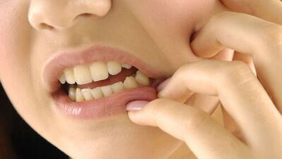 Çocuklarda diş çürümesini önlemenin yolları