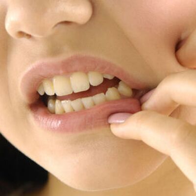 Çocuklarda diş çürümesini önlemenin yolları