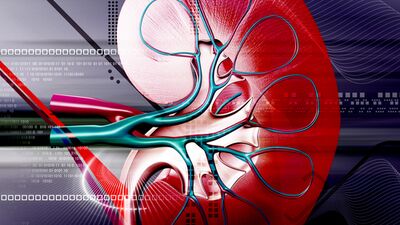 Hangi yiyecekler böbrek taşı yapar?