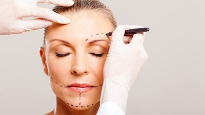 Face lifting nedir?