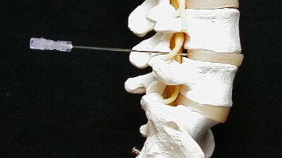 Boyun ağrılarında fizik tedavi ve rehabilitasyon