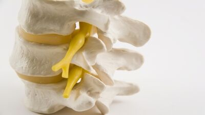 Boyun fıtığı nedir?