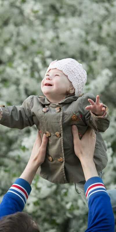 Down sendromu hakkında bilmeniz gereken şeyler var