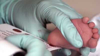 Fenilketonüri nedir?