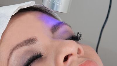 Cilt çatlaklarına lazer uygulaması...