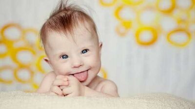 Down sendromu risk belirleme testi; 11–14 testi