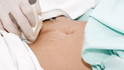 Birinci trimester ultrasonografisi