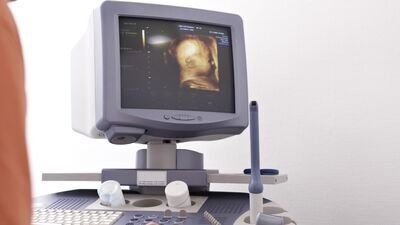 Birinci düzey ayrıntılı ultrasonografi