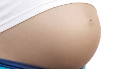 Tek yumurta ikiz gebeliğinin farklı şekilleri