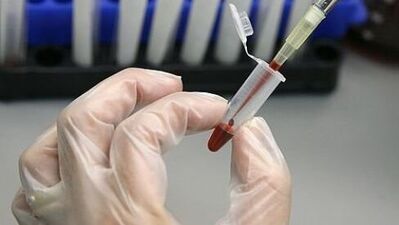 Üçlü test hakkında merak edilenler