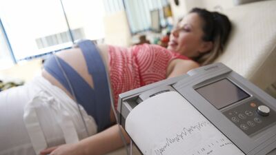 NST (Non-stress Test) nedir?