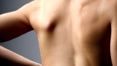 Sırttaki yaralara aloevera