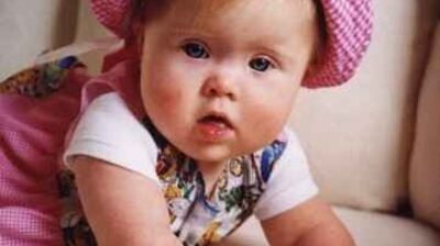 Down sendromlu çocuklar gecikmeli gelişmeler gösterirler!