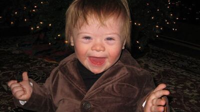 Down sendromu neden ortaya çıkar?