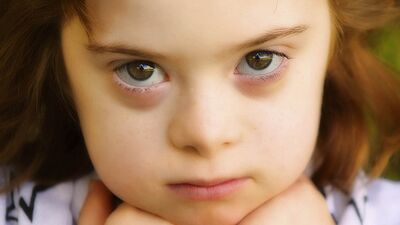 Down sendromu çocuğu nasıl etkiler?