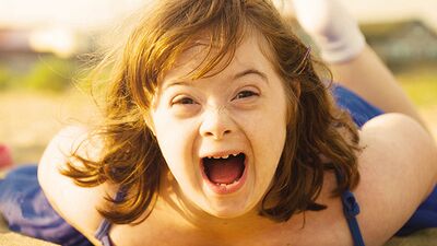 Down sendromu hakkında unutulmaması gerekenler